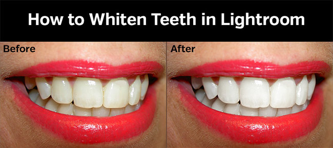 How to Whiten Teeth in Lightroom